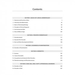 Solved Papers Dermatology for PG Students: A Must for MD and DNB | Chapter-wise Q&A with Hand-drawn Illustrations for Quick… - A