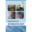 Snapshots in Dermatology, 2/E: Visual Guide for UG and PG Medical Students | 300+ Clinical Photographs, Dermoscopic Details,…