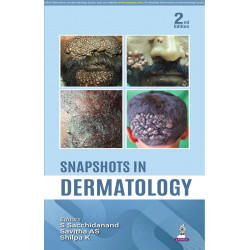 Snapshots in Dermatology, 2/E: Visual Guide for UG and PG Medical Students | 300+ Clinical Photographs, Dermoscopic Details,…
