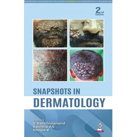 Snapshots in Dermatology, 2/E: Visual Guide for UG and PG Medical Students | 300+ Clinical Photographs, Dermoscopic Details,…