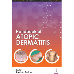 HANDBOOK OF ATOPIC DERMATITIS book by Rashmi Sarkar