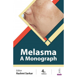 Melasma: A Monograph book by Rashmi Sarkar