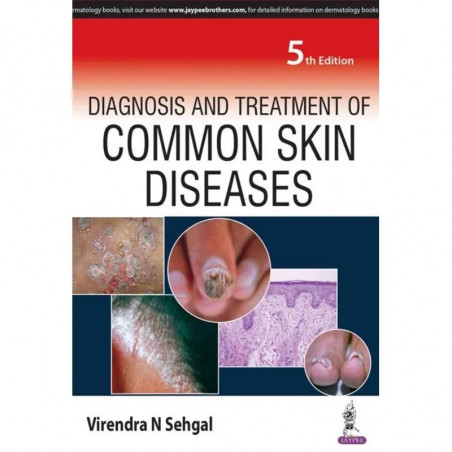 Diagnosis and Treatment of Common Skin Diseases book by Sehgal Virendra N