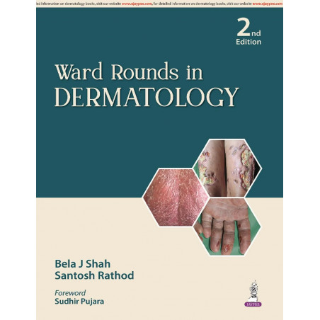 WARD ROUNDS IN DERMATOLOGY book by Bela J Shah, Santosh Rathod