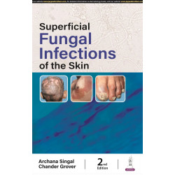 SUPERFICIAL FUNGAL INFECTIONS OF THE SKIN book by Archana Singal, Chander Grover