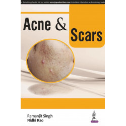 ACNE & SCARS book by Singh Ramanjit