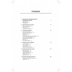 ACNE & SCARS book by Singh Ramanjit - Additional Image 5