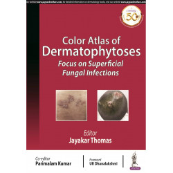COLOR ATLAS OF DERMATOPHYTOSES: FOCUS ON SUPERFICIAL FUNGAL INFECTIONS book by Parimalam Thomas,Jayakar ; Kumar