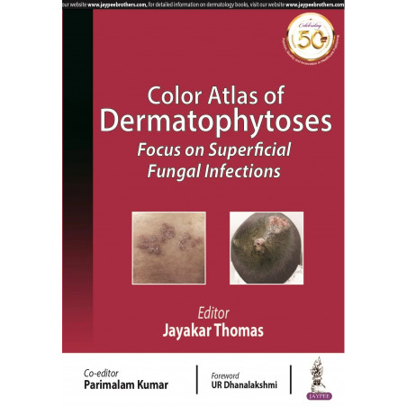 COLOR ATLAS OF DERMATOPHYTOSES: FOCUS ON SUPERFICIAL FUNGAL INFECTIONS book by Parimalam Thomas,Jayakar ; Kumar