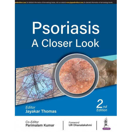 PSORIASIS: A CLOSER LOOK book by Jayakar Thomas
