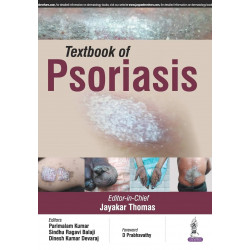 Textbook of Psoriasis book by Thomas Jayakar