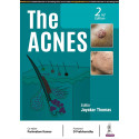THE ACNES book by Jayakar Thomas, Parimalam Kumar