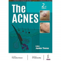 THE ACNES book by Jayakar Thomas, Parimalam Kumar - Back Cover