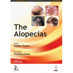 THE ALOPECIAS book by Jayakar thomas, Parimalam Kumar