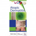 Atopic Dermatitis book by Satish Udare