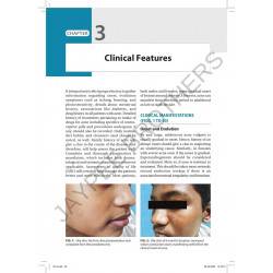 THE ACNES book by Jayakar Thomas, Parimalam Kumar - Additional Image 6