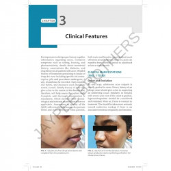 THE ACNES book by Jayakar Thomas, Parimalam Kumar - Additional Image 7