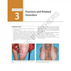 MANUAL OF DERMATOLOGY IN GENERAL PRACTICE book by Prof Dr Md Rokon Uddin - Additional Image 8
