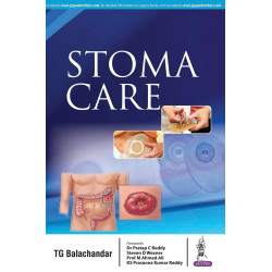 STOMA CARE book by TG Balachandar