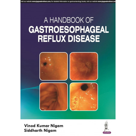 A HANDBOOK OF GASTROESOPHAGEAL REFLUX DISEASE book by "Vinod Kumar Nigam ", Siddharth Nigam