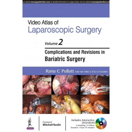 VIDEO ATLAS OF LAPAROSCOPIC SURGERY VOL.2 ,COMPLICATIONS AND REVISIONS IN BARIATRIC SURGERY WITH DVD book by Rana Pullatt