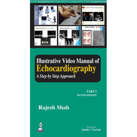 Illustrative Video Manual of Echocardiography for Beginners: A Step by Step Approach (Part I) (POD) book by Rajesh Shah, Sat…
