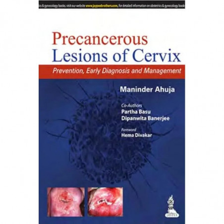 PRECANCEROUS LESIONS OF CERVIX PREVENTION,EARLY DIAGNOSIS AND MANAGEMENT book by Ahuja Maninder