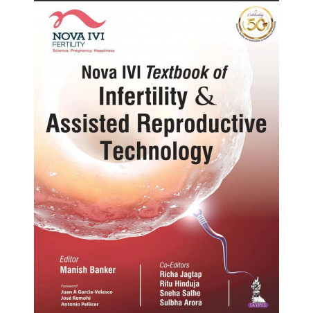 Nova IVI Textbook of Infertility and Assisted Reproductive Technology book by Manish Banker