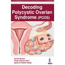 DECODING POLYCYSTIC OVARIAN SYNDROME (PCOS) book by Kanthi Bansal, Pooja Sharma Dimri