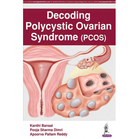 DECODING POLYCYSTIC OVARIAN SYNDROME (PCOS) book by Kanthi Bansal, Pooja Sharma Dimri