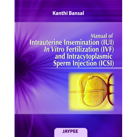 Manual of Intrauterine Insemination (IUI) In Vitro Fertilization (IVF) and Intracytoplasmic Sperm Injection (ICSI) book by B…