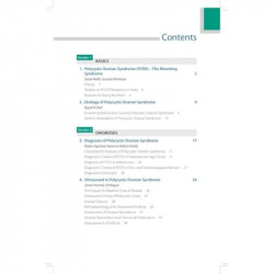 DECODING POLYCYSTIC OVARIAN SYNDROME (PCOS) book by Kanthi Bansal, Pooja Sharma Dimri - Additional Image 6