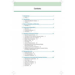 OBS AND GYNAE PG FOCUS SERIES CAESAREAN BIRTH PAST, PRESENT AND OPTIMIZING THE FUTURE book by Niranjan Chavan, Komal N Chavan -