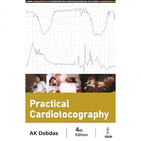 PRACTICAL CARDIOTOCOGRAPHY book by AK Debdas
