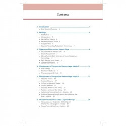 OBS AND GYNAE PG FOCUS SERIES POSTPARTUM HEMORRHAGE & INTERNAL ILIAC ARTERY LIGATION book by Niranjan Chavan, Komal N Chavan - A