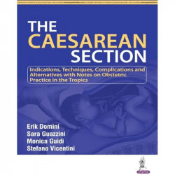 The Caesarean Section book by M.D. Domini, Erik, M.D. Guazzini, Sara