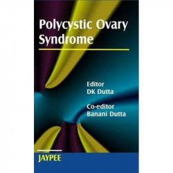 POLYCYSTIC OVARY SYNDROME book by Dutta