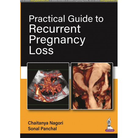PRACTICAL GUIDE TO RECURRENT PREGNANCY LOSS book by Chaitanya Nagori