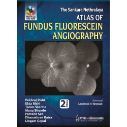 The Sankara Nethralaya: Atlas of Fundus Fluorescein Angiography book by Rishi Pukhraj