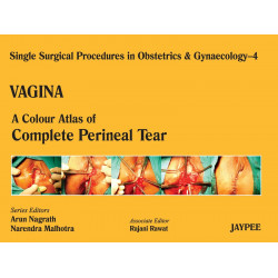 VAGINA-4:A.C.A.OF COMPLETE PERINEAL TEAR (SSPO&G): A Colour Atlas of Perineal Tear book by Nagrath
