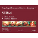 UTERUS 14 : A.C.A. OF CAESAREAN SECTION (SINGLE SURGICAL PROCEDURES IN OBS & GYNE) book by Nagrath