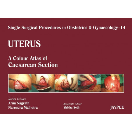 UTERUS 14 : A.C.A. OF CAESAREAN SECTION (SINGLE SURGICAL PROCEDURES IN OBS & GYNE) book by Nagrath