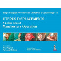 Single Surgical Procedures in Obstetrics & Gynaecology – 17 Uterus-Displacements: A Colour Atlas of Manchester’s Operation b…