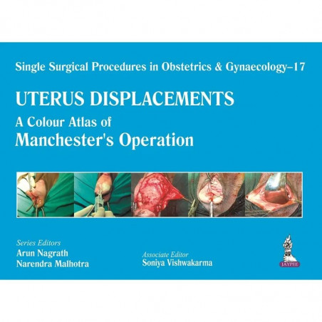 Single Surgical Procedures in Obstetrics & Gynaecology – 17 Uterus-Displacements: A Colour Atlas of Manchester’s Operation b…
