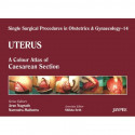 UTERUS 14 : A.C.A. OF CAESAREAN SECTION (SINGLE SURGICAL PROCEDURES IN OBS & GYNE) book by Nagrath - Back Cover
