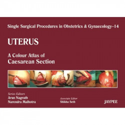 UTERUS 14 : A.C.A. OF CAESAREAN SECTION (SINGLE SURGICAL PROCEDURES IN OBS & GYNE) book by Nagrath - Back Cover