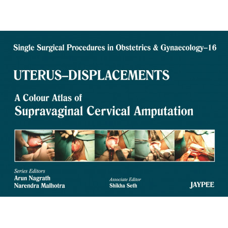 Single Surgical Procedures in Obstetrics and Gynaecology-16: A Colour Atlas of Supravaginal Cervical Amputation (Nadkarni's)…