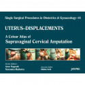 Single Surgical Procedures in Obstetrics and Gynaecology-16: A Colour Atlas of Supravaginal Cervical Amputation (Nadkarni's)… -