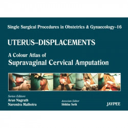 Single Surgical Procedures in Obstetrics and Gynaecology-16: A Colour Atlas of Supravaginal Cervical Amputation (Nadkarni's)… -