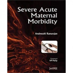 SEVERE ACUTE MATERNAL MORBIDITY book by Ramarajan